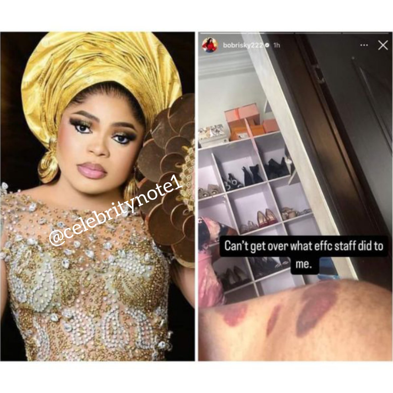 bobrisky injury efcc